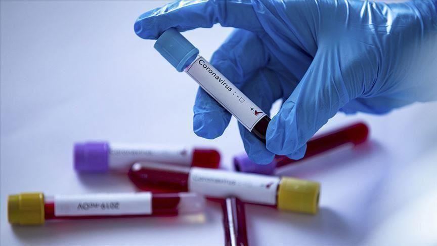 تونس: وزارة الصحة تأذن لـ 84 مختبرا خاصا بإجراء اختبار RT-PCR